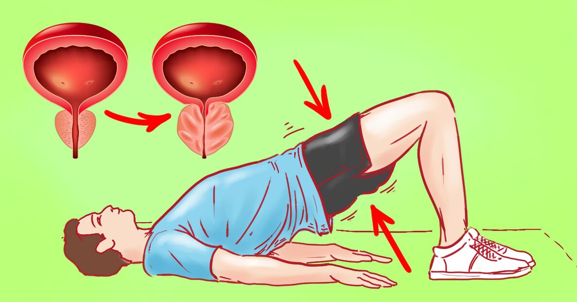 Gimnastikos pratimai prostatitui gydyti